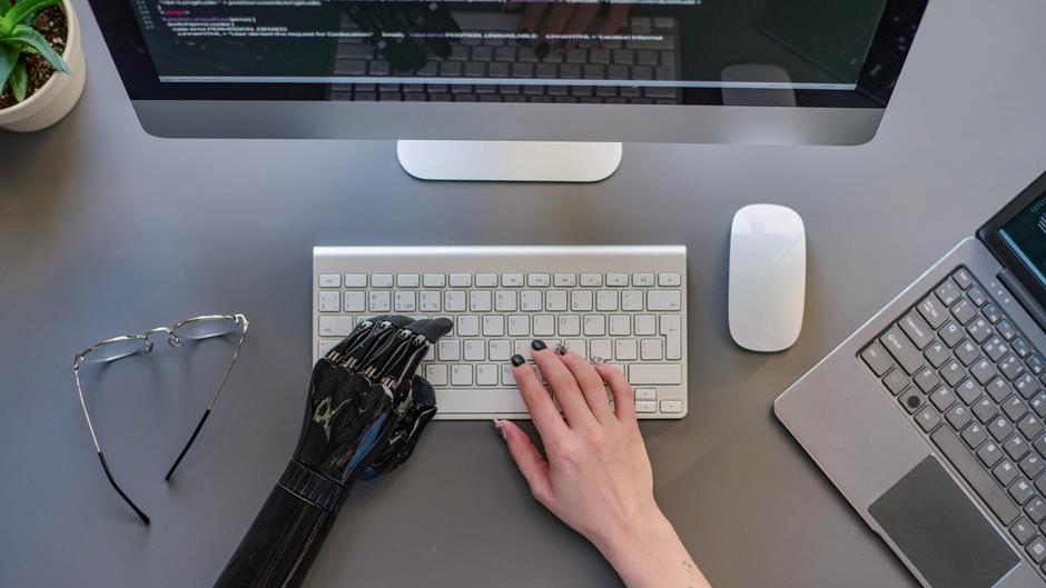 Eine schwarze Prothese und eine menschliche Hand tippen auf einer Computer-Tastatur, daneben eine Maus und eine Brille.